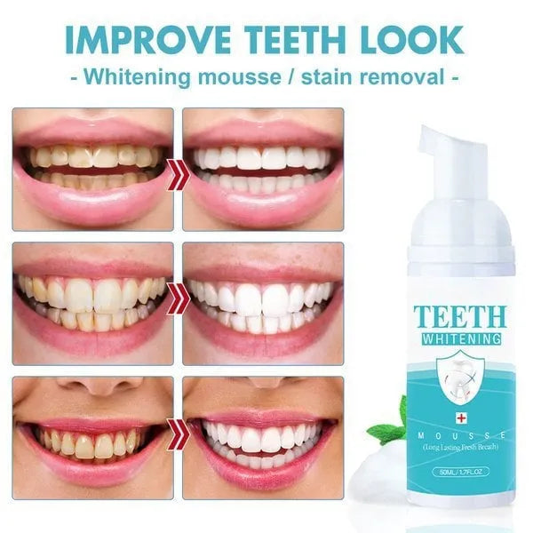 Teeth Whitening Mousse